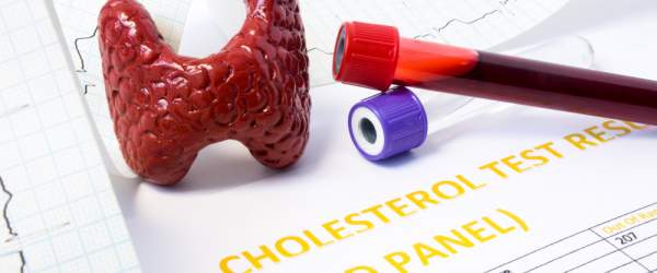 Hypocholesterolémia – máme se z nej radovať, alebo sa jej obávať?